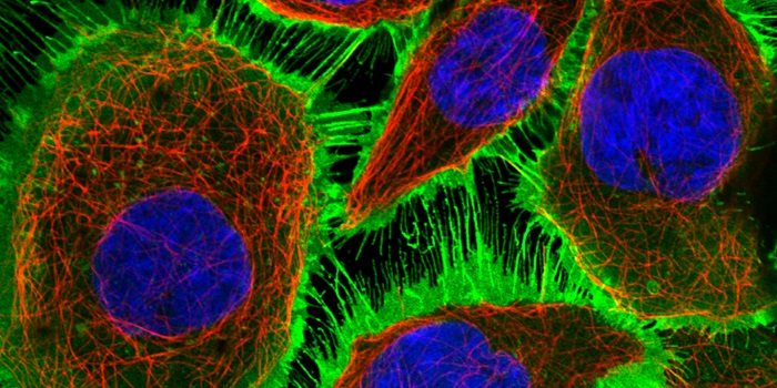 The protein EGFR (epidermal growth factor receptor) is visualized using confocal microscopy and immunofluorescent reporters in a human cell line (A-431). EGFR is localized to the plasma membrane (green). The cytoskeleton and microtubules are shown in red and the nucleus in blue. Photo: Chalmers University of Technology