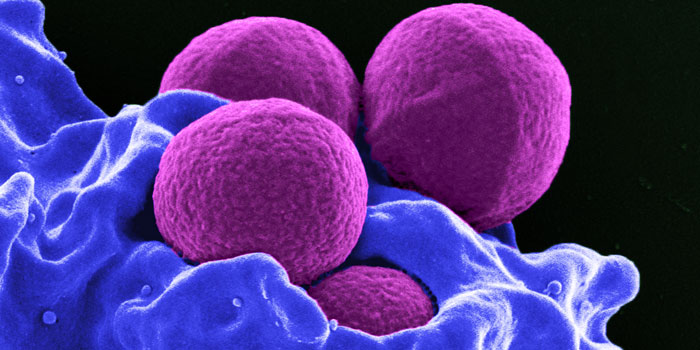 The antimicrobal reistant bacteria MRSA. Photo: National Institute of Allergy and Infectious Deseases (NIAID).
