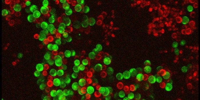 Svampeceller i en biofilm: De grønne celler ”ligger i dvale” og de røde celler er dræbt af et svampemiddel. Foto: DTU Veterinærinstituttet