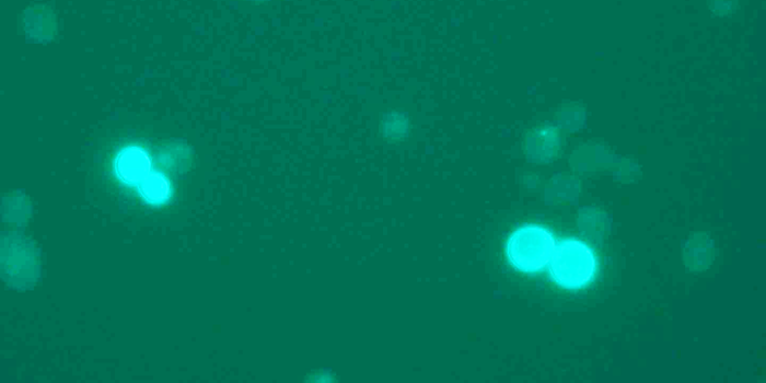 Fluorescent yeast cells microscope