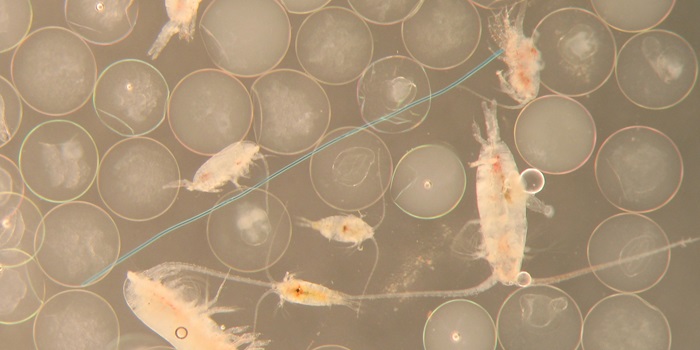 FIskeæg og dyreplankton (vandlopper) og en blå plastfiber. Foto: Bastian Huwer.