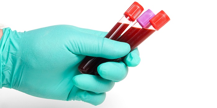 Method to analyse and separate cells in blood.
