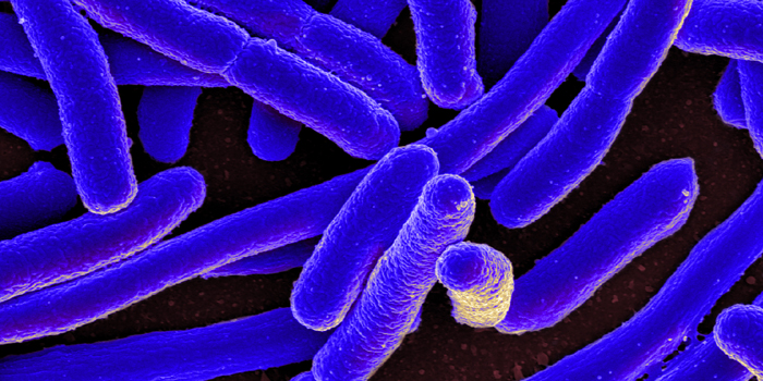 E.coli (SEM) by NIAID from Flickr