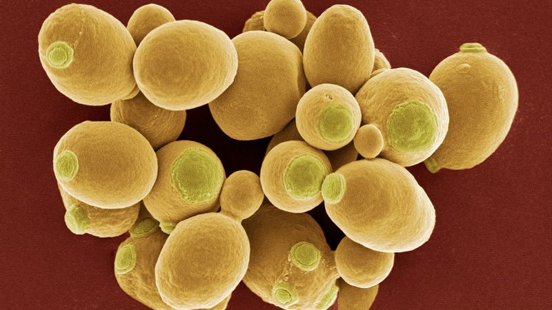 Yeast cells, SEM. Credit: STEVE GSCHMEISSNER.