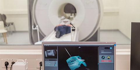 Kameraet er monteret på scanneren og tracker patientens bevægelser, mens scanningen finder sted. Lægerne kan følge bevægelserne i 3D på en skærm, som her på Rigshospitalet.