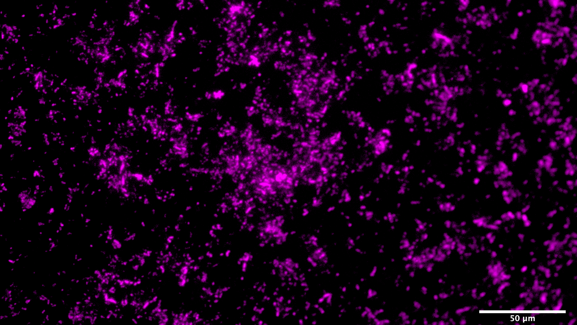 Nathalie has used microscopy and fluorescent probes to look for where Phaeobacter sits in the moss animals.