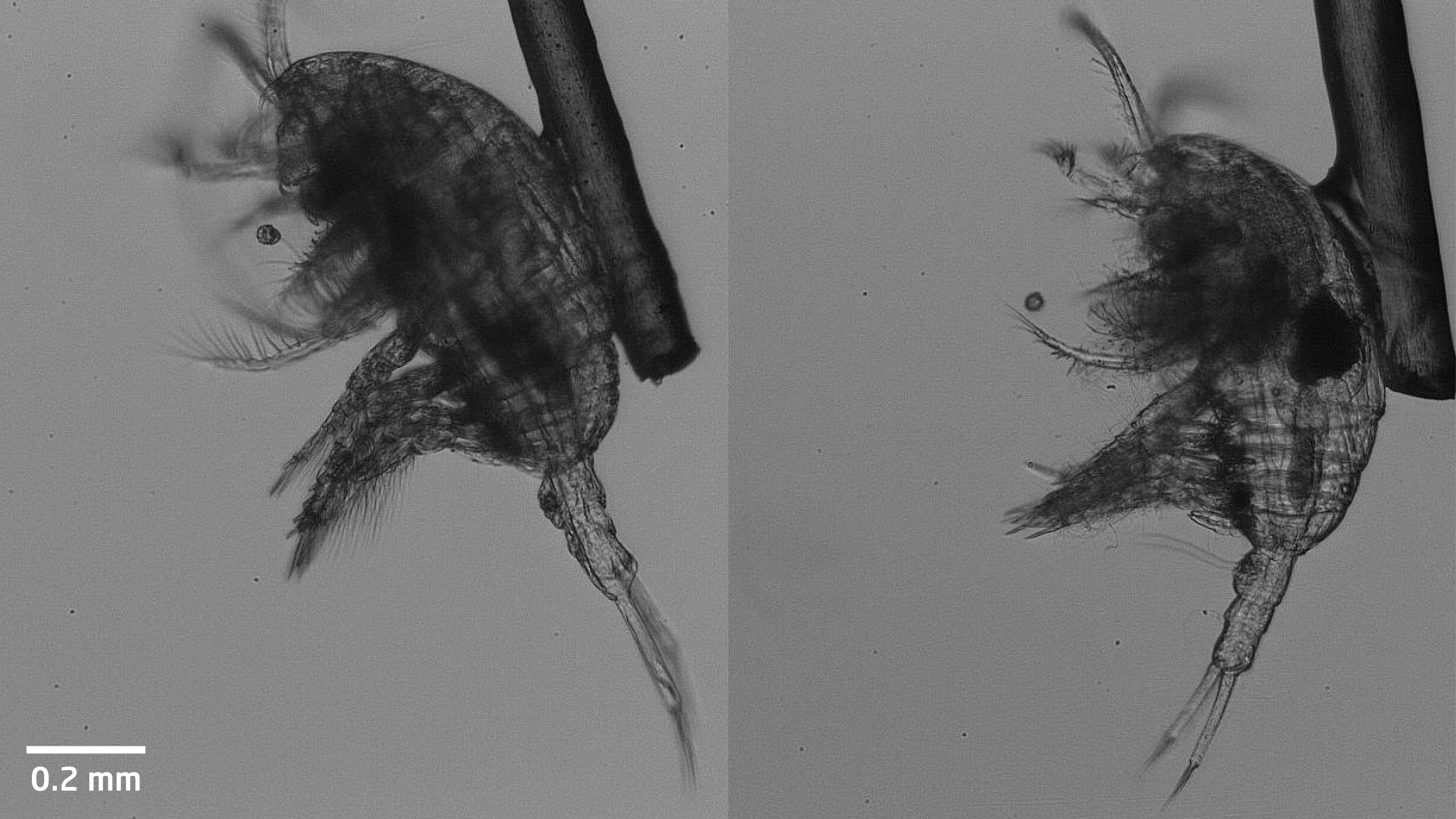 Copepods glued to human hair.